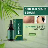 Markaway Stretch Mark Serum | Advanced Body Care for Smooth, Hydrated Skin