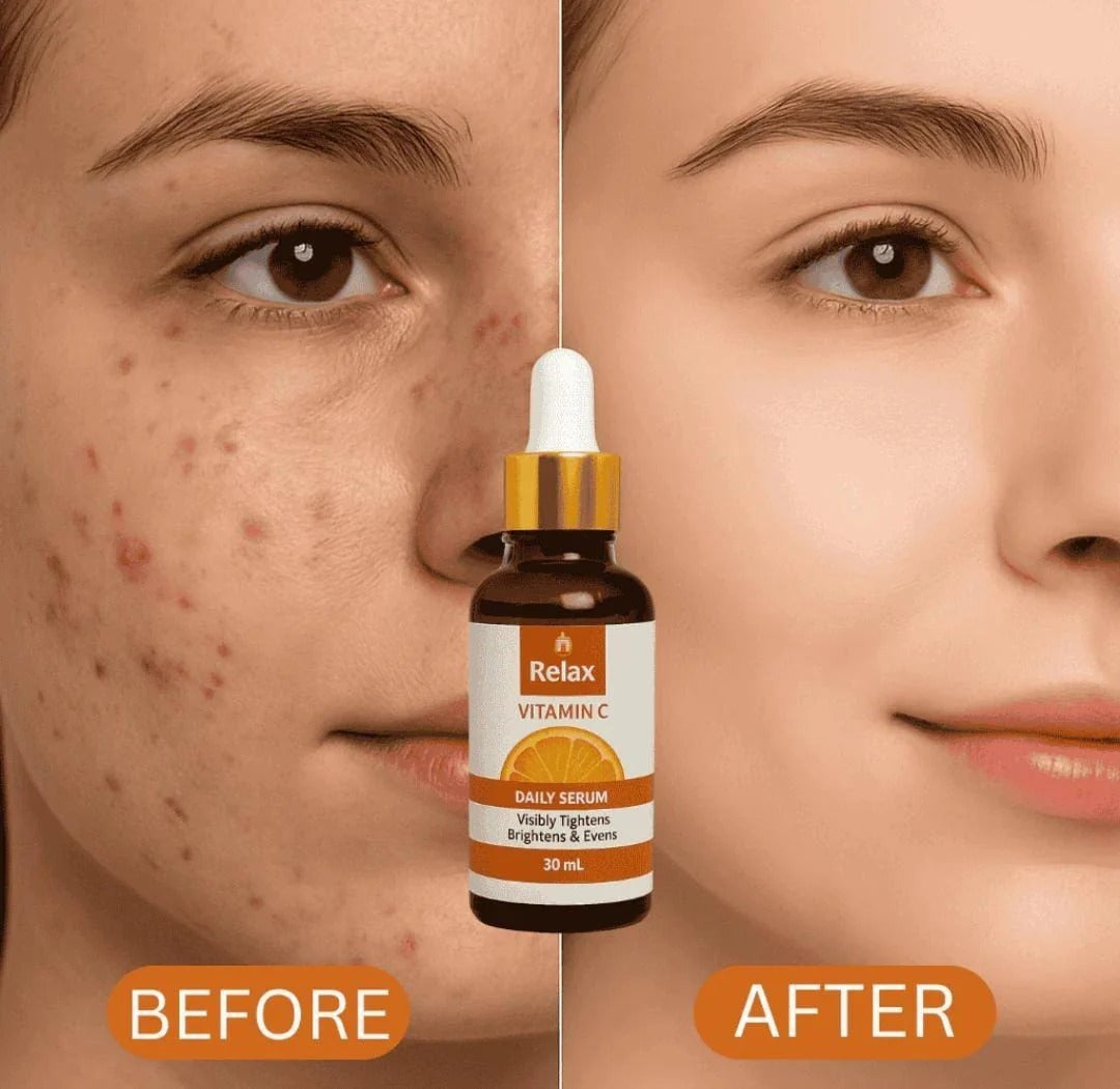 Relax Vitamin C Daily Serum 30ml | Brightening &amp; Anti-Aging Facial Serum